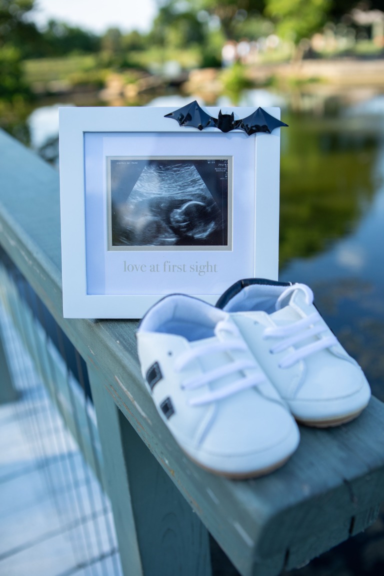 Tiny white shoes and an ultrasound announcing a baby